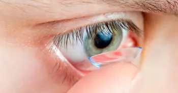 scleral contact lens fitting